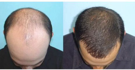 hair fixing training